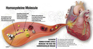 Homocysteine-Damage-Ladd-McNamara[1]