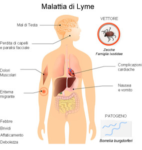 malattia-lyme-sintomi
